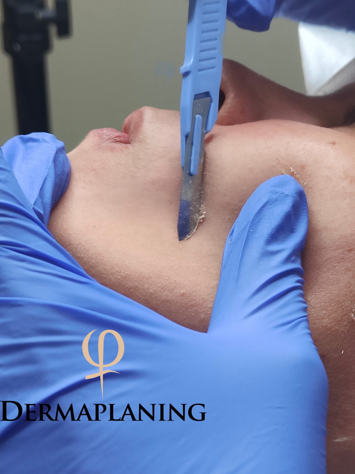 Dermaplaning in esecuzione